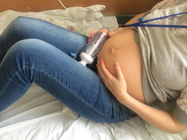 Лечение геморроя при беременности и после родов.jpg